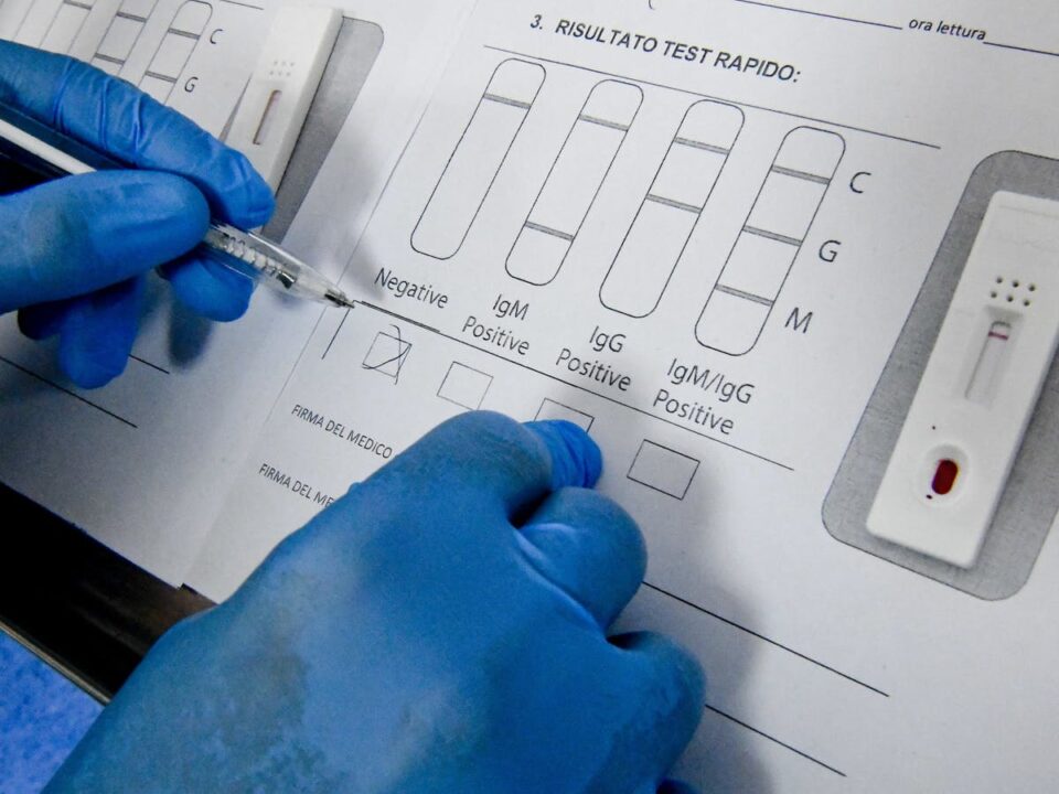 pcr